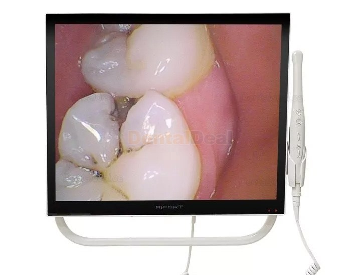 Magenta YFHD-D Intraoral Camera with 17 Inch Monitor & Bracket 1/4 sony CCD